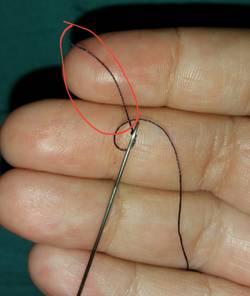 What-Happens-if-a-Sewing-Needle-Goes-in-Your-Body