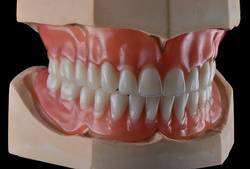 Can-You-Bleach-Acrylic-Teeth